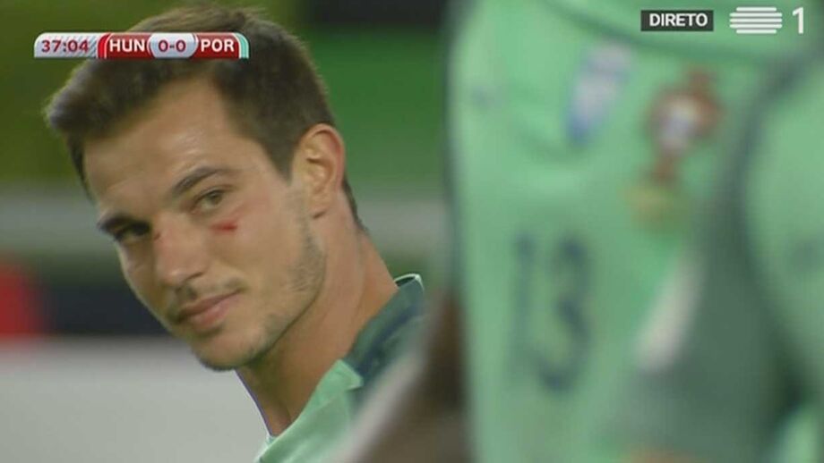 Dzsudzsák deixou Cédric neste estado...
