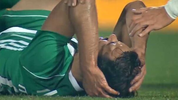 Marcelo (Rio Ave) chocou contra adversário e ficou com este impressionante 'galo'