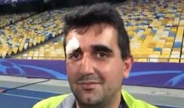 Ronaldo ofereceu camisola após atingir operador de câmara com a bola