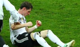 Impressionante: Rudy saiu em sangue do duelo da Alemanha