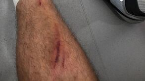 Semedo 'tatua' Corchia