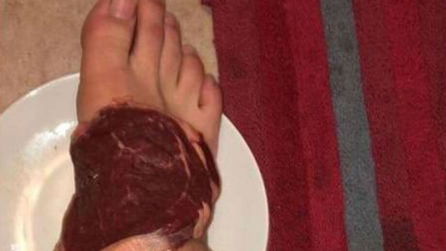 Jogador inglês pede ajuda a fisioterapeuta, engana-se no número e acaba com um bife no pé