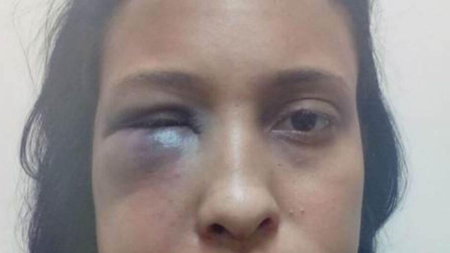 Agredida por futebolista confessa: «É um milagre estar viva»