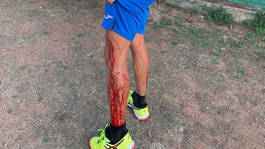 Puyol foi jogar padel, partiu vidro de campo e acabou... cheio de sangue