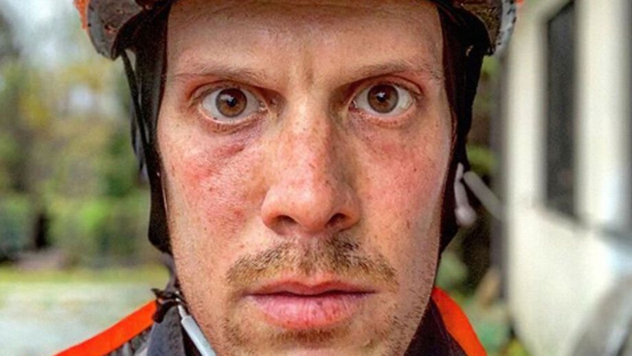 «Este é o rosto daquele que quase mataste»: ciclista italiano arrasa