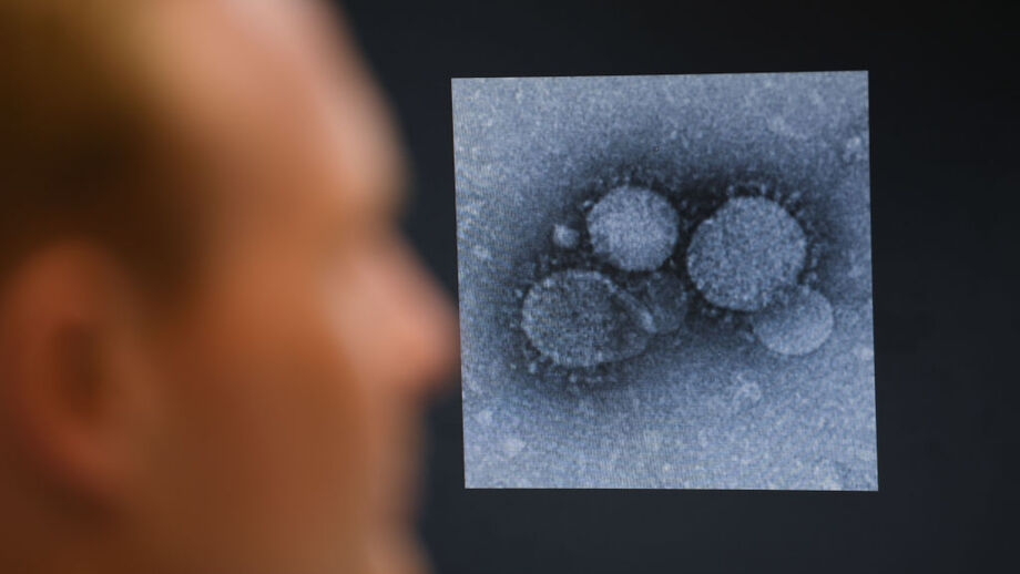 virus coronavirus