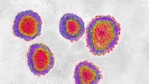 Liga anuncia medidas para evitar a propagação do coronavírus