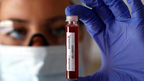 Coronavírus: Bolonha com caso suspeito que pode obrigar a quarentena do plantel