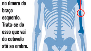 A lesão de Alvaro Pereira