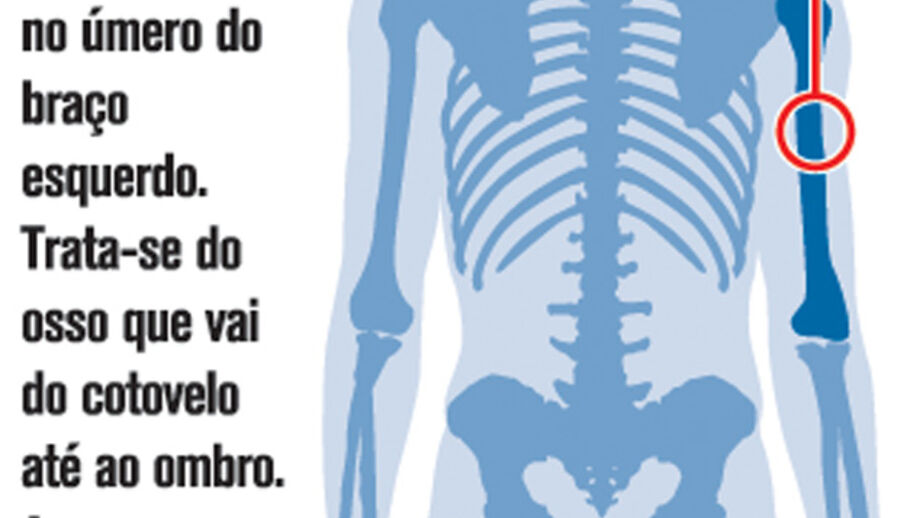 A lesão de Alvaro Pereira