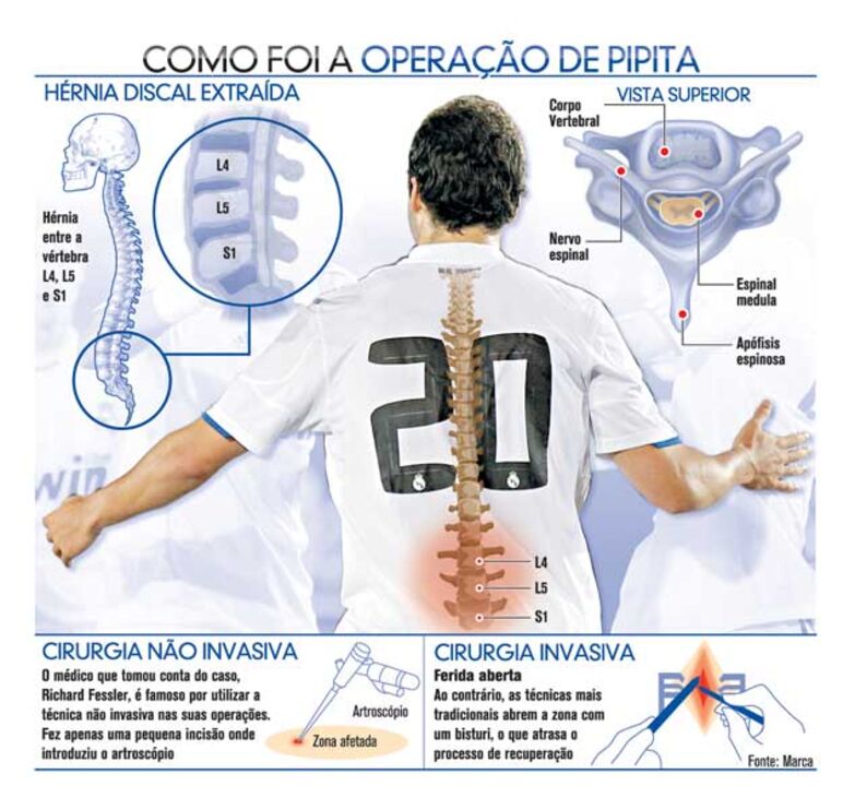 Como foi a operação de Higuaín