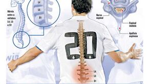 Como foi a operação de Higuaín