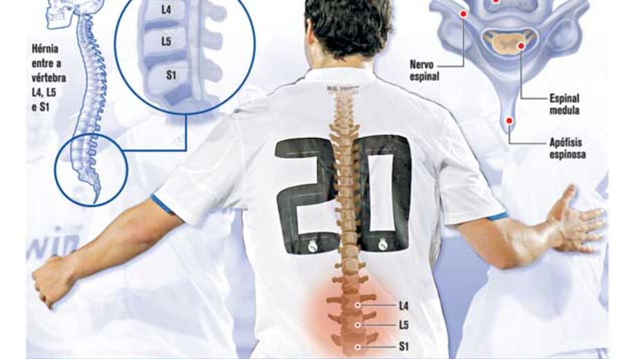 Como foi a operação de Higuaín