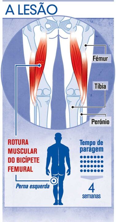 A lesão de Di María