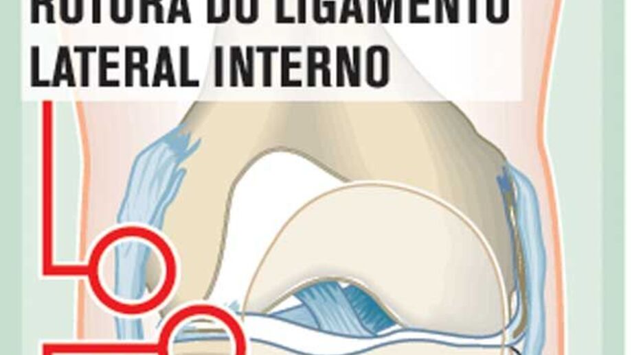Lesão de Onyewu à lupa