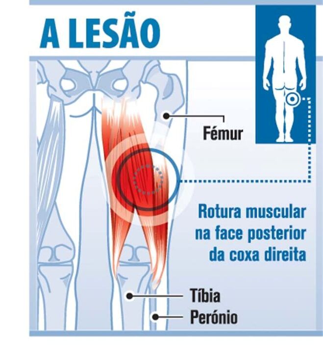 Lesão de Djalma à lupa