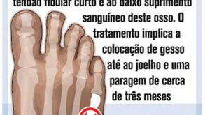 Lesão de Marcelo à lupa