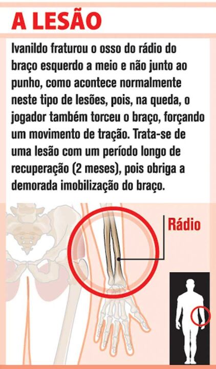 A lesao e Ivanildo