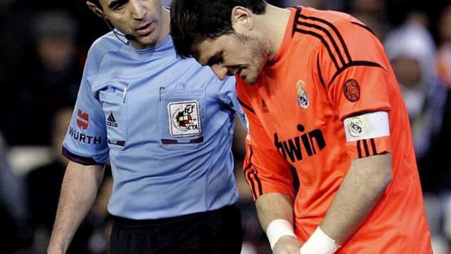 Casillas com fratura na mão esquerda