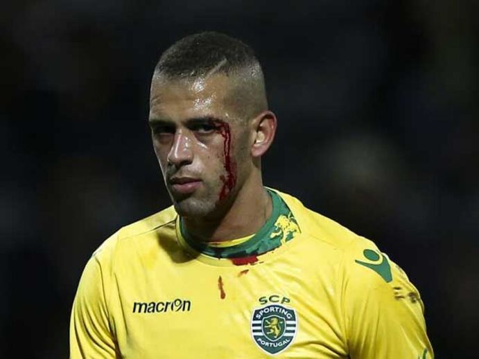 Sobrolho aberto não trava Slimani 