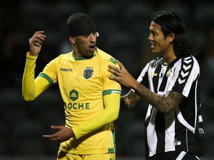 Sobrolho aberto não trava Slimani 