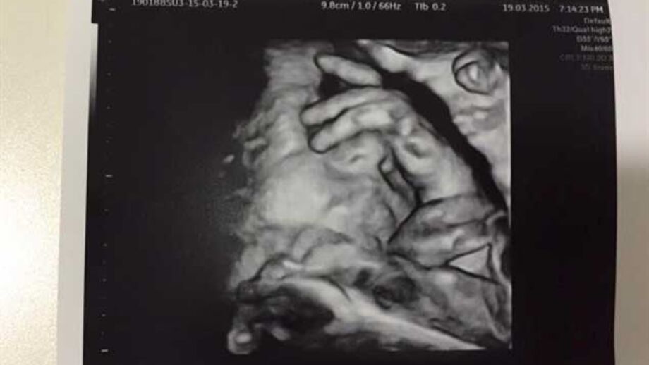 André Villas-Boas mostra reação do filho ao tempo de compensação... dentro da barriga da mãe