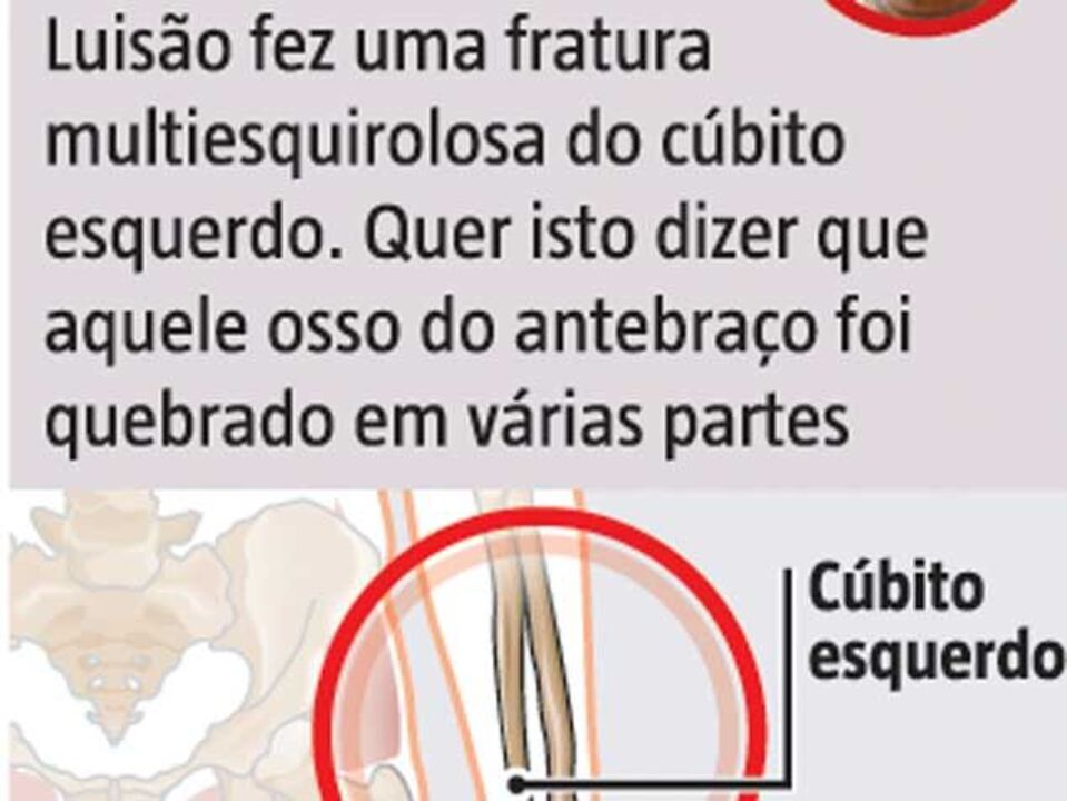 Lesão de Luisão à lupa
