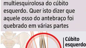 Lesão de Luisão à lupa
