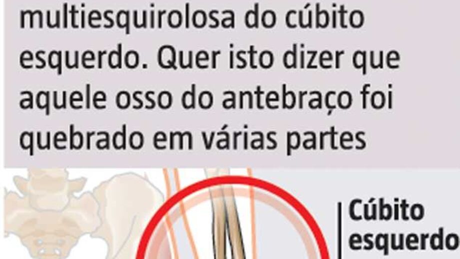 Lesão de Luisão à lupa