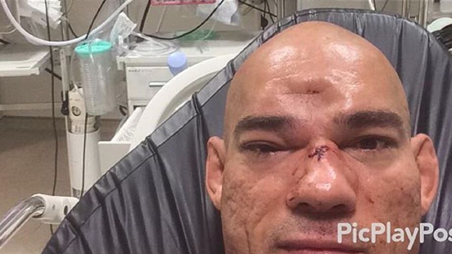 Imagem da testa foi partilhada pela ex-mulher