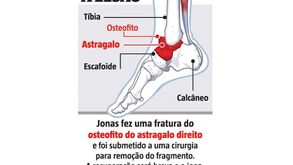 A lesão que obrigou Jonas a ser operado