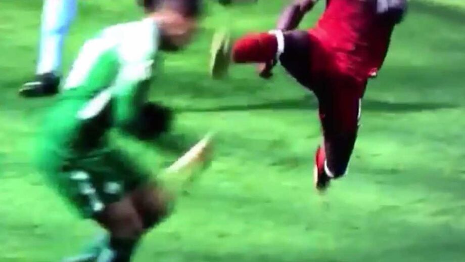 Mané atingiu guarda-redes do City no maxilar