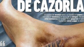 Arrepiante: assim está o pé de Santi Cazorla após oito operações