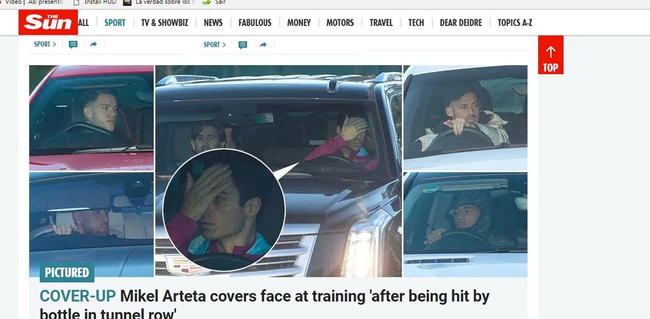 Adjunto de Guardiola tapa marca da agressão no túnel de Old Trafford