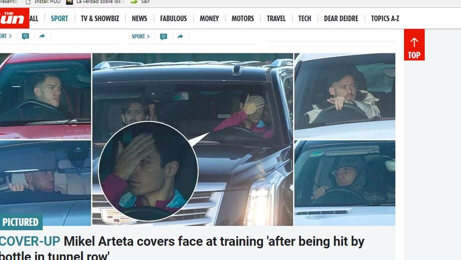 Adjunto de Guardiola tapa marca da agressão no túnel de Old Trafford