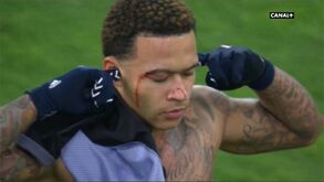 Depay deu a vitória ao Lyon aos 90' e acabou a sangrar na celebração