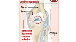 Lesão de Ebuehi à lupa: o que se passou com o lateral do Benfica