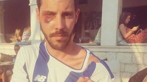 Adeptos do FC Porto queixam-se de terem sido agredidos na Croácia
