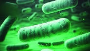 Legionella