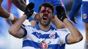 Imagens impressionantes: Nelson Oliveira ficou quase irreconhecível após ser pisado na cara