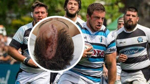 Lance impressionante no râguebi: «Quando senti o corte, a cabeça estava rachada ao meio»