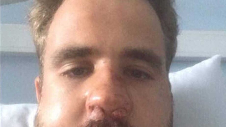 Assim ficou o adepto portista agredido após clássico com o Benfica