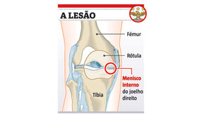 A lesão de Florentino ao pormenor