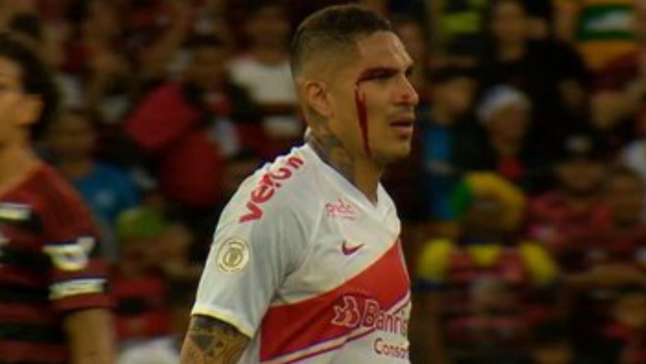 Guerrero sangrou, levantou o dedo e saiu mais cedo: a atitude que Jorge Jesus criticou 