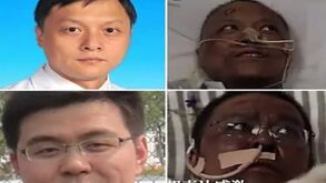 Comunidade científica em choque: médicos chineses acordam do coma com pele negra