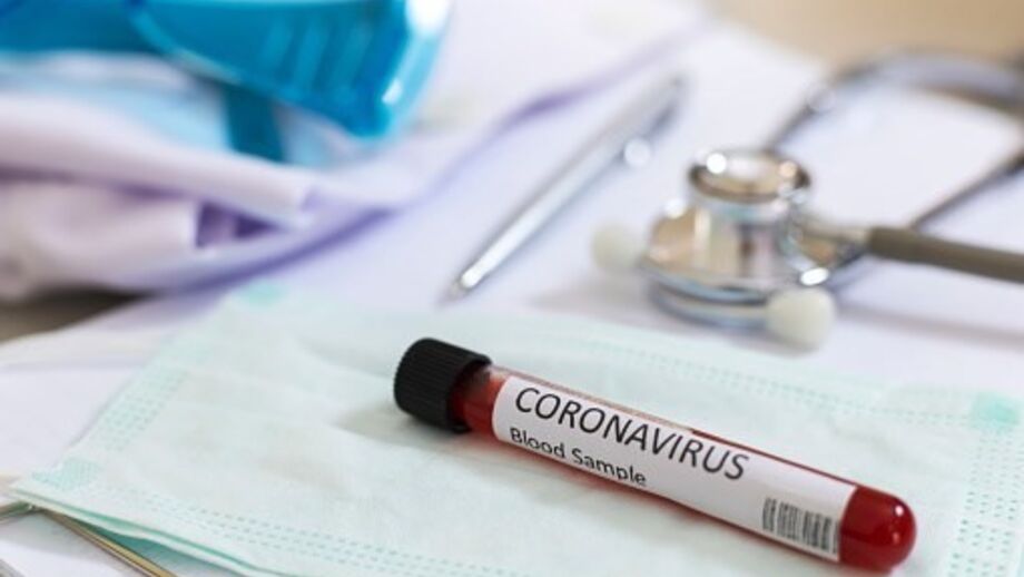 Teste coronavírus