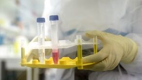 Estudo diz que pessoas com este tipo de sangue podem estar mais protegidas contra a covid-19 