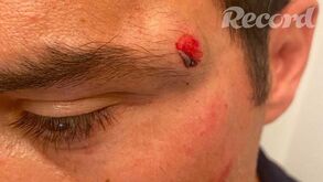 «Fui abordado por três apoiantes de Bruno de Carvalho que me agrediram»