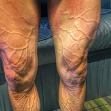 A impressionante imagem das pernas de ciclista espanhol na Vuelta'2020