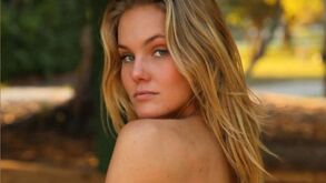 Ex-campeã de Wimbledon denuncia insultos após partilhar foto em topless
